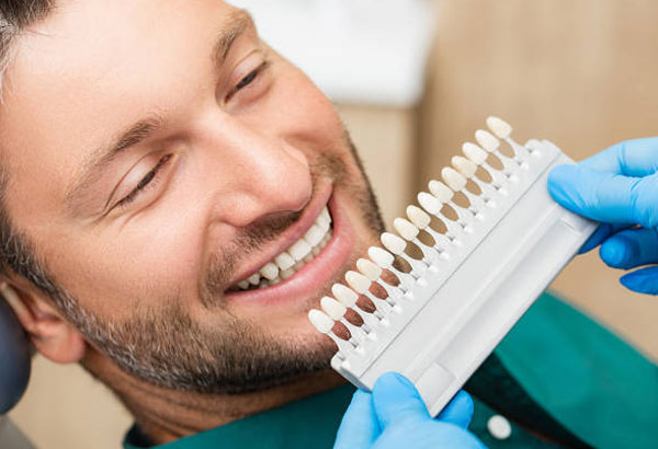 Everything you need to know about porcelain veneers